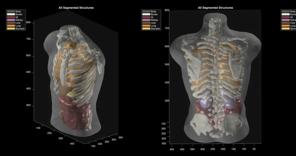 Midjourney Medical goes from AI image generation to full-body ultrasounds